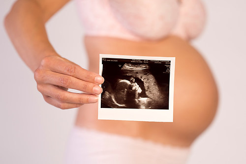 Babybauch-Fotografie-Berlin